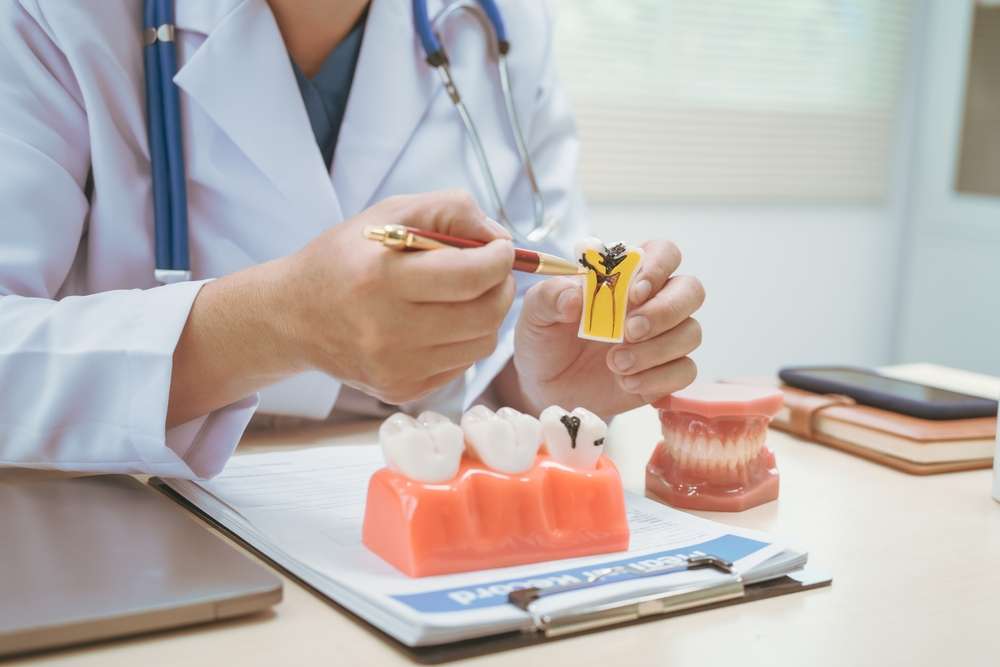 How Much Is A Root Canal In Ontario?